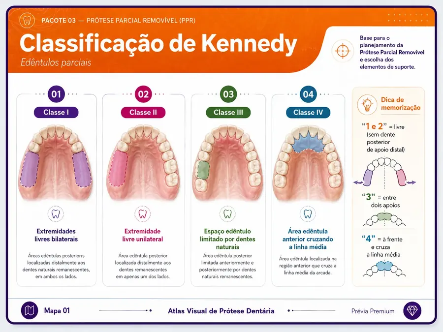 Classificação de Kennedy